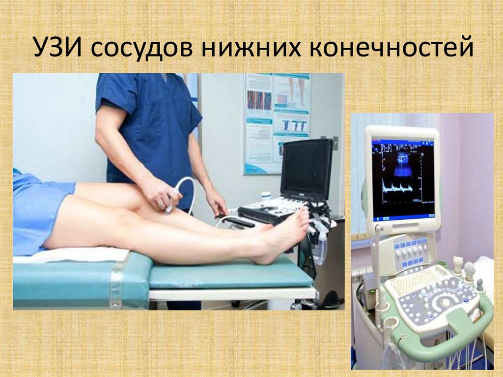 Узи сосудов платно