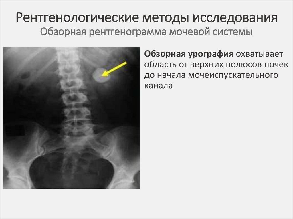 Исследование почек