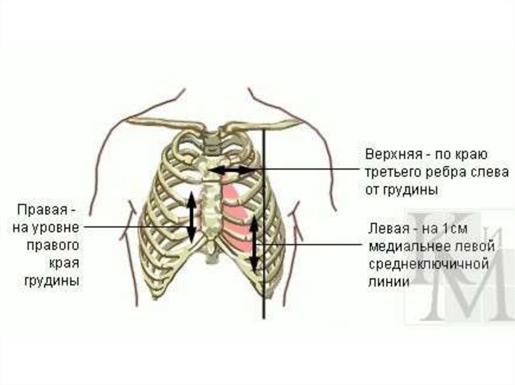 Перкуссия сердца границы сердца расширены. Проекция клапанов сердца на грудную клетку схема. Границы расположения сердца. Топография сердца в грудной клетке. Верхушка сердца топография.
