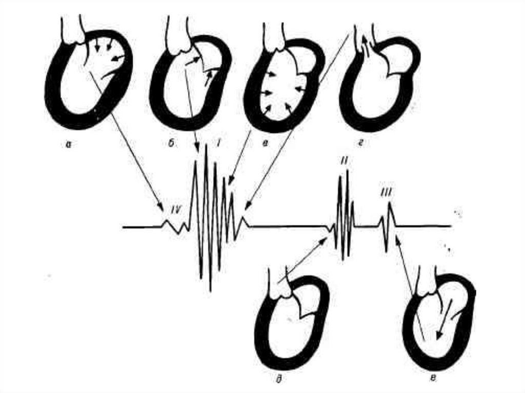 Тоны сердца схема