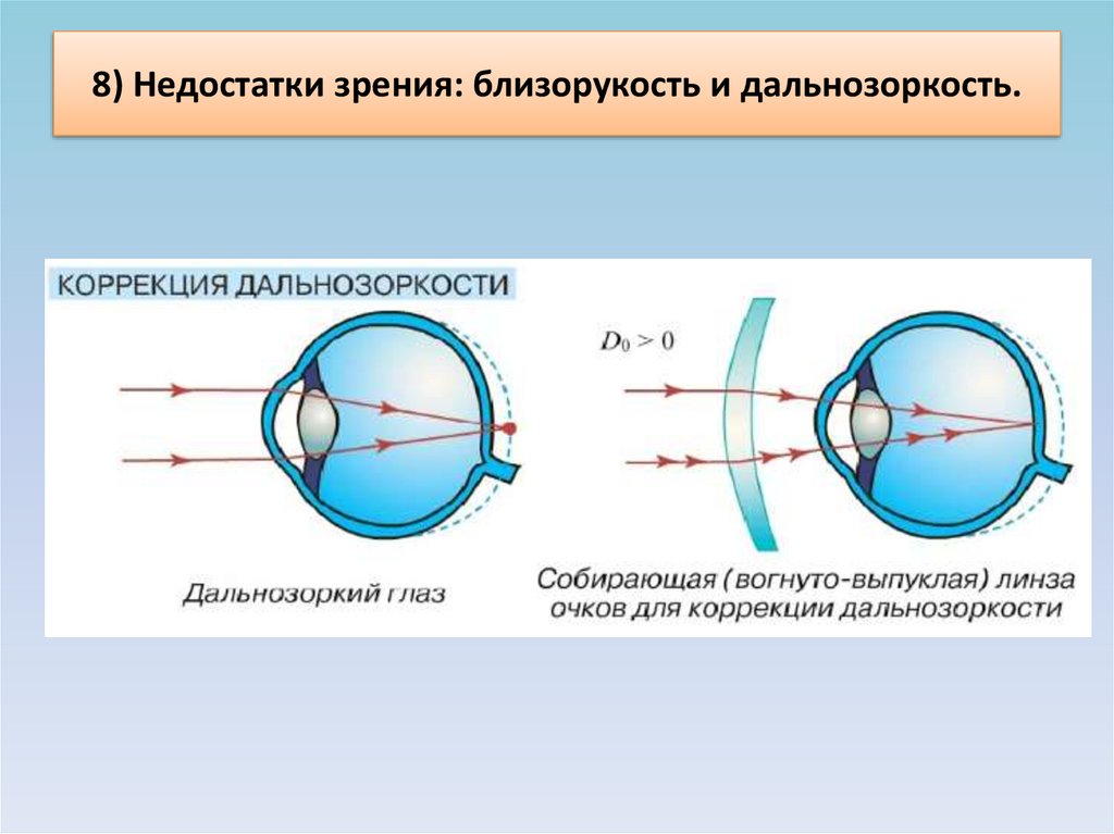 Исправление близорукости физика рисунок