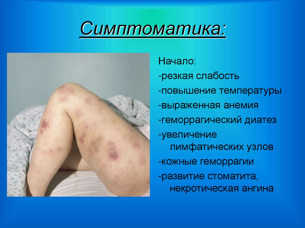 Симптоматика: