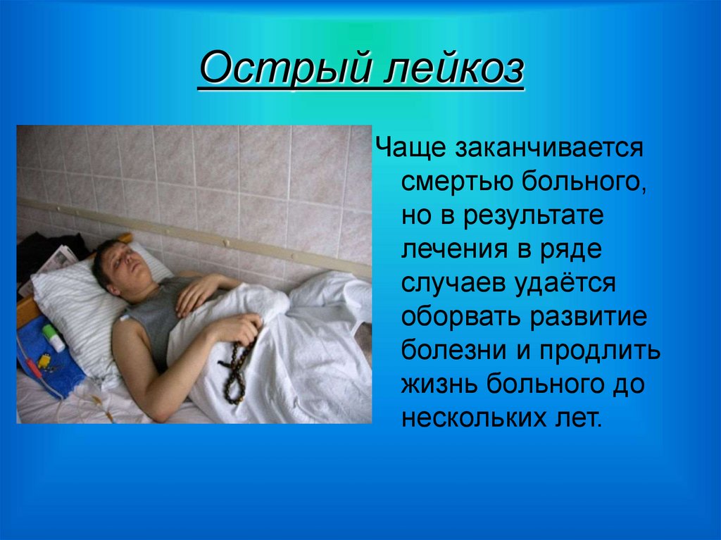 Острый лейкоз