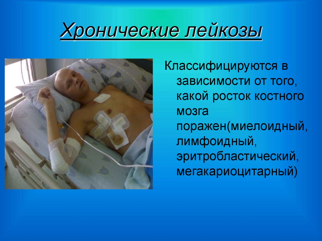 Хронические лейкозы