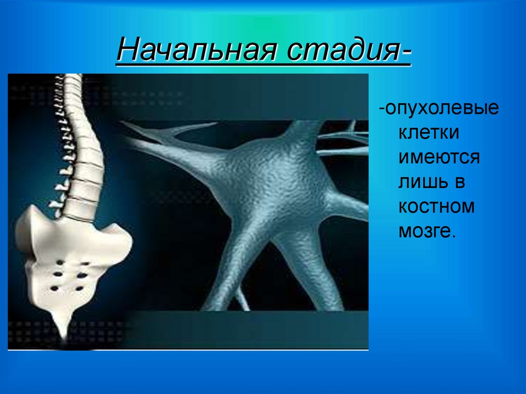 Начальная стадия-