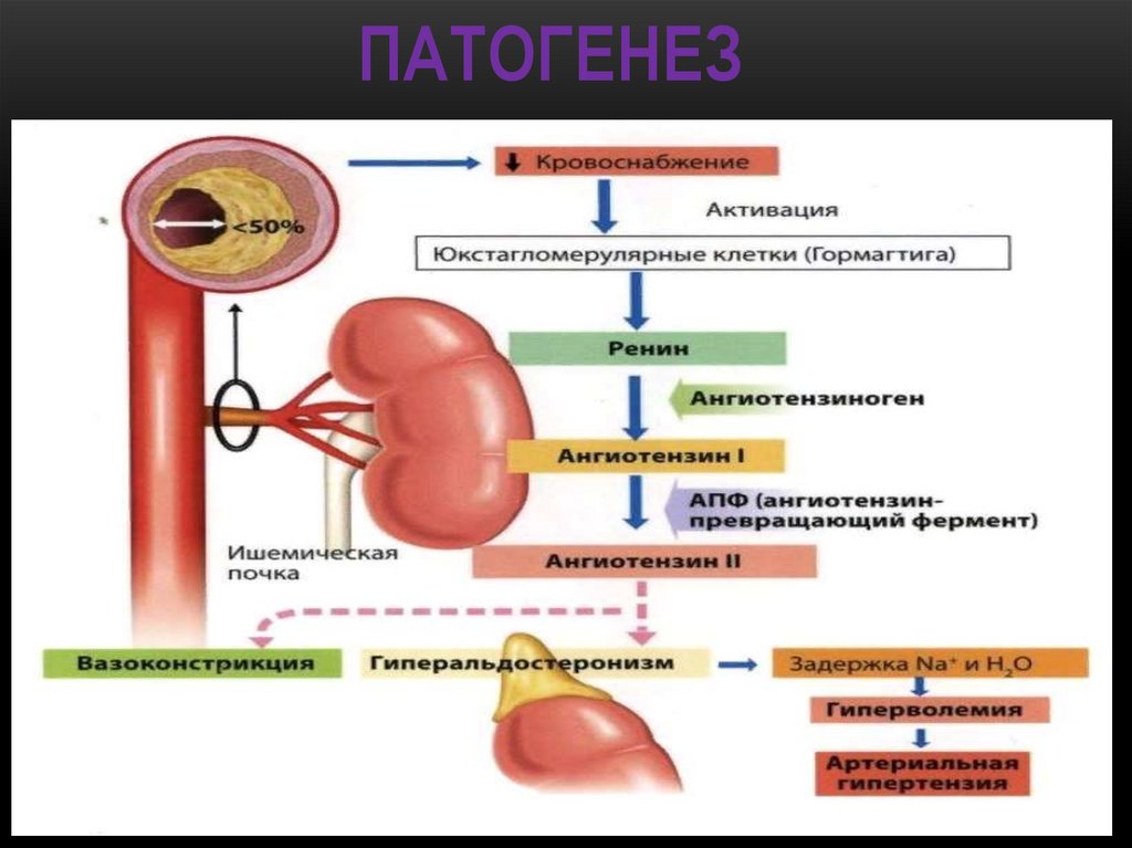 Вазоренальная гипертензия презентация