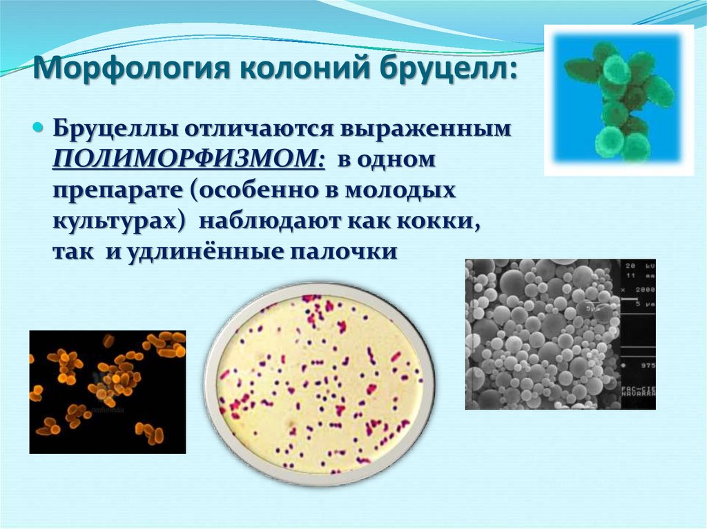 Бруцеллез презентация. Brucella Melitensis микробиология. Brucella Melitensis морфология. Бруцеллез микробиология таксономия. Возбудитель бруцеллеза микробиология.
