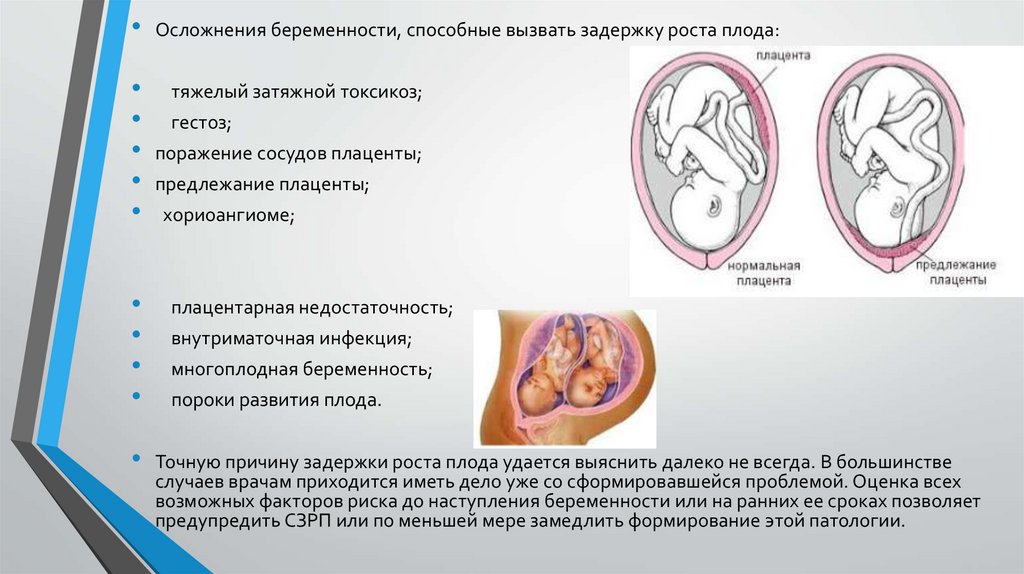 Задержка внутриутробного развития плода презентация. Причины задержки внутриутробного развития плода. Задержка роста плода презентация. Презентация «задержка внутриутробного развития (ЗВУР).