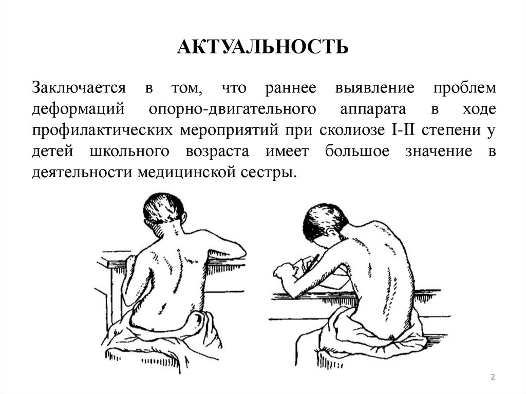 Сколиоз 1 степени у детей лечение. Массаж при сколиозе 1 степени. Массаж при сколиозе у детей.