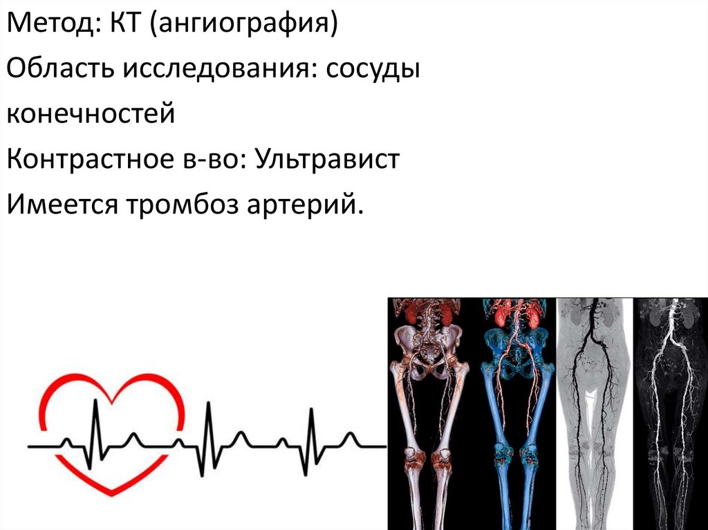 Область исследования