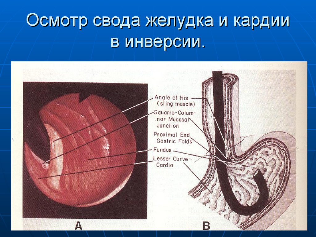 Эндоскопические признаки кардии. Пищевод желудок Кардия. Кардия желудка что это такое анатомия. Строение кардии желудка. Пищевод и желудок анатомия.