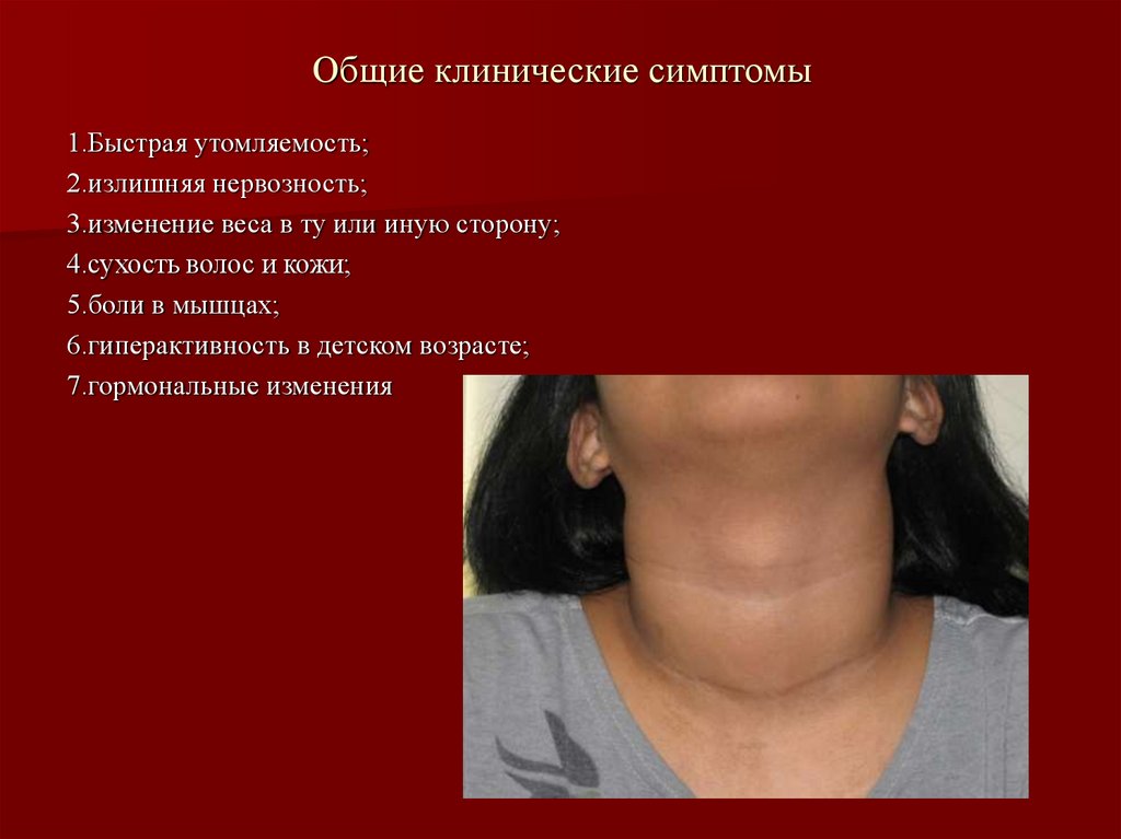 Общие клинические симптомы