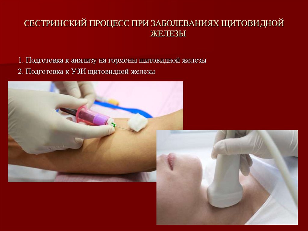 СЕСТРИНСКИЙ ПРОЦЕСС ПРИ ЗАБОЛЕВАНИЯХ ЩИТОВИДНОЙ ЖЕЛЕЗЫ