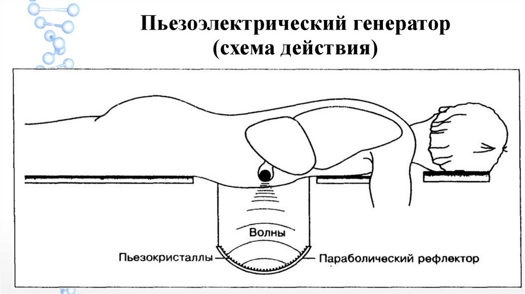 Схема ультразвуковая терапия