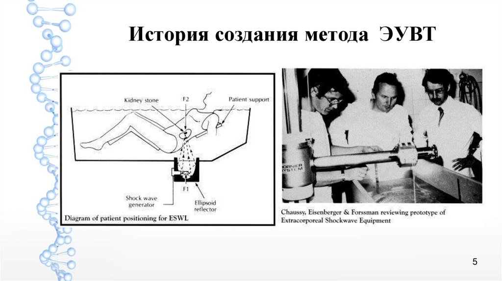 Создание метода. Схем ударно волнового аппарата. Эувт экстракорпоральная ударно-волновая терапия. Эувт экстракорпоральная ударно-волновая терапия в урологии. Эувт.