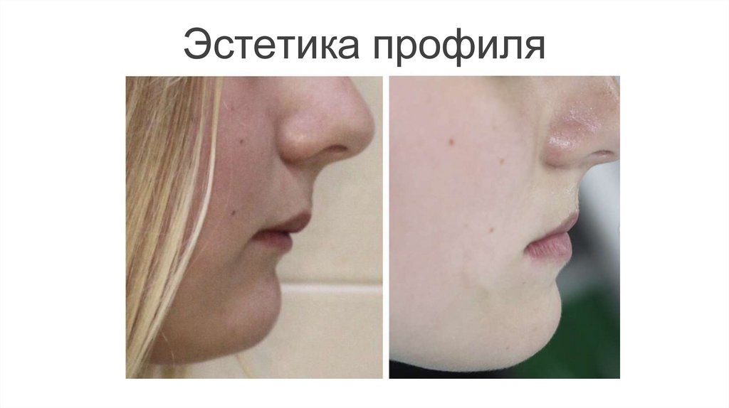 Эстетика профиля