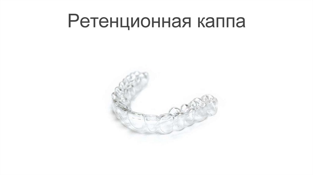 Ретенционная каппа