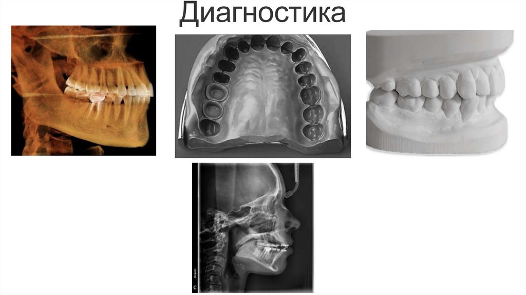 Диагностика