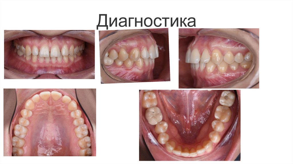 Диагностика