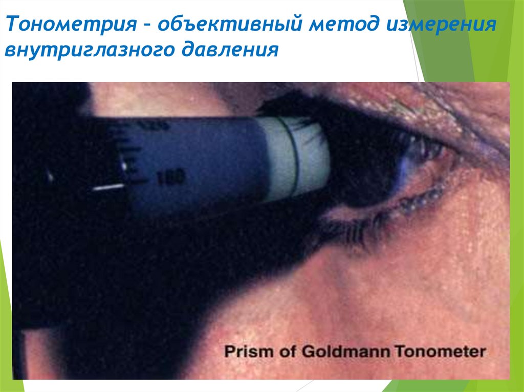 Тонометрия норма. Тонометрия (измерение внутриглазного давления). Тонометрия внутриглазного давления норма. Тонометрия при глаукоме.