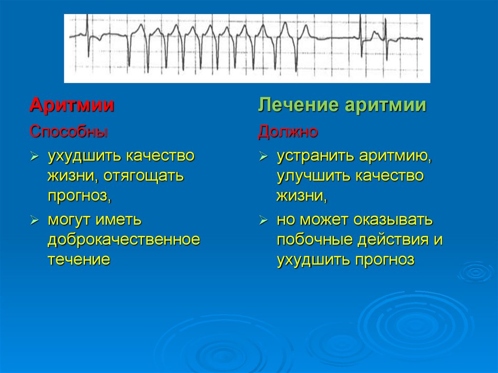 Лечение аритмий презентация