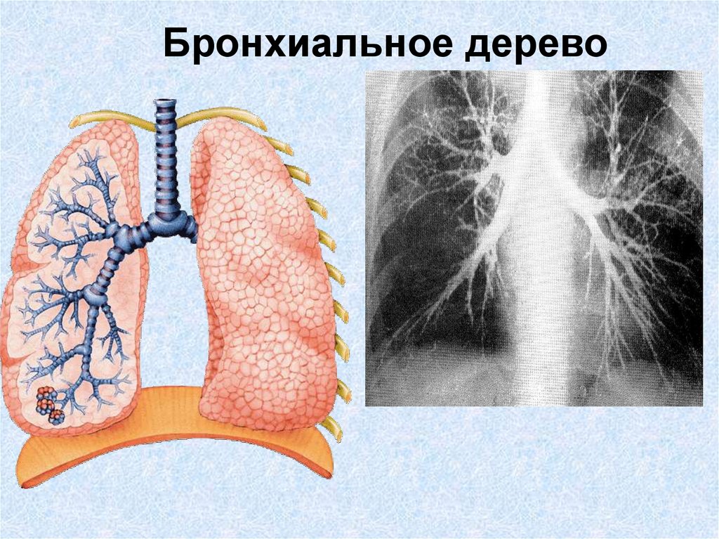 Аномалии бронхиального дерева. Аномалии развития дыхательной системы. Пороки развития органов дыхания. Аномалии развития дыхательной системы анатомия.