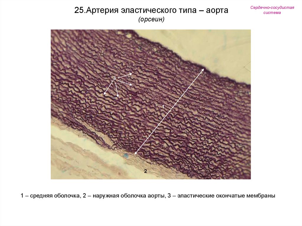 Артерия эластического типа рисунок