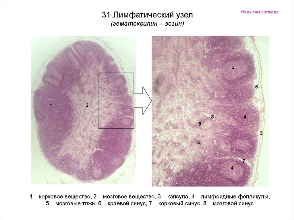 Лимфоузел гистология рисунок