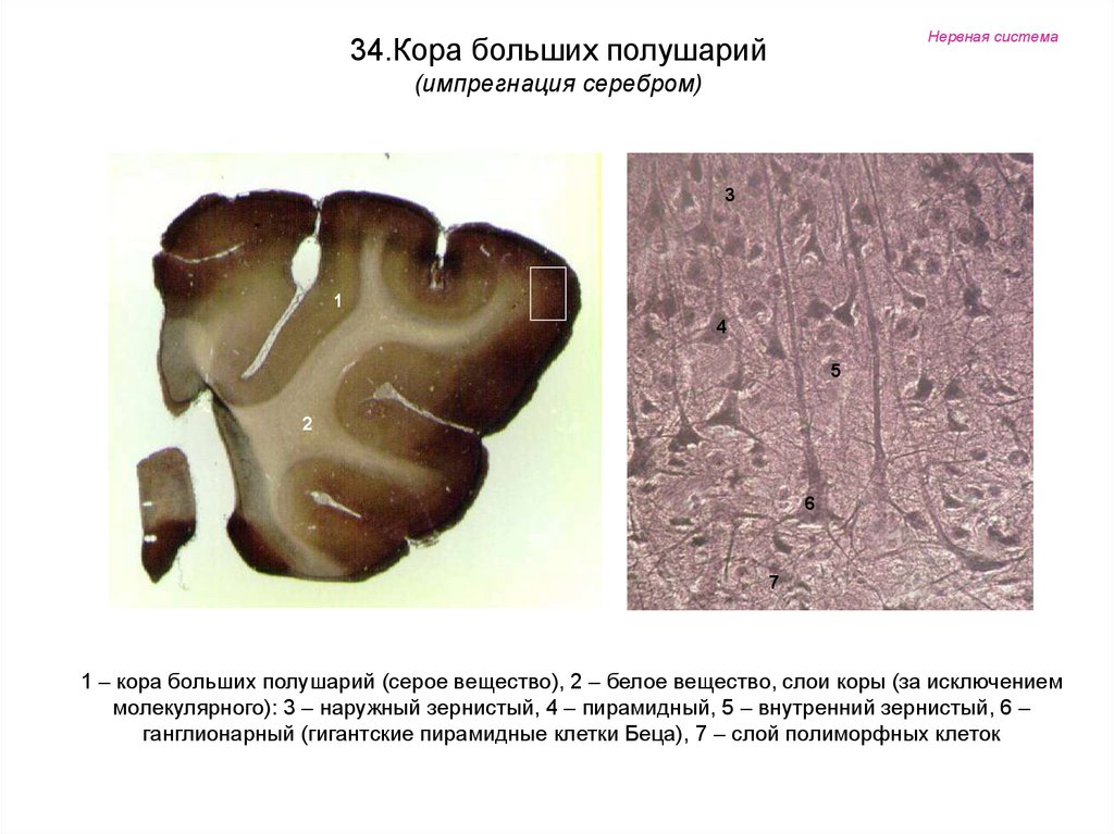 Кора больших полушарий головного мозга рисунок гистология