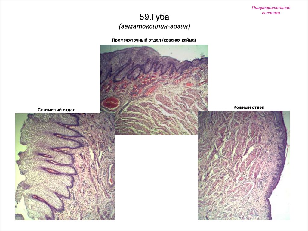 Отдел слизистый. Красная кайма губ гистология. Красная кайма гистология. Промежуточный отдел (красная кайма губ).