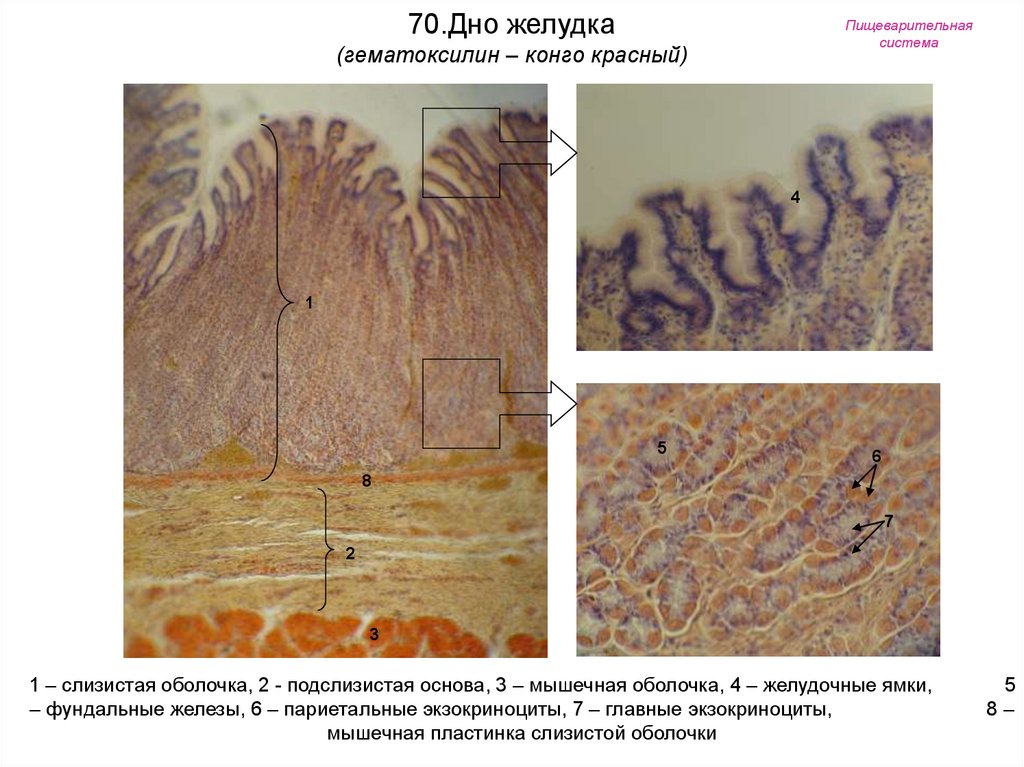 Дно желудка гистология рисунок