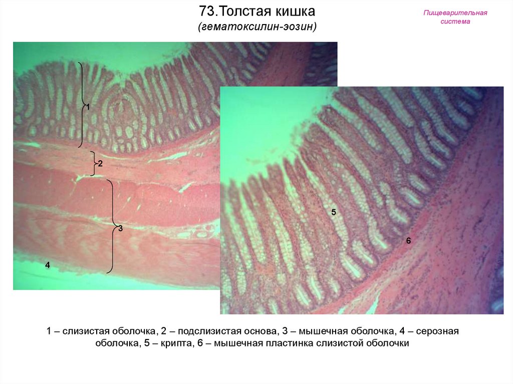 Толстая оболочка. Серозная оболочка толстой кишки гистология. Толстая кишка гистология препарат. Крипты Толстого кишечника гистология. Толстая кишка гистология слизистой.