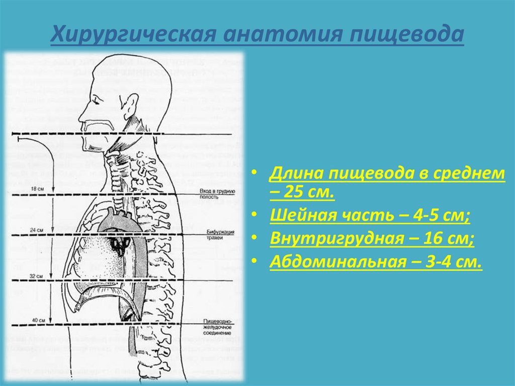 Укажите скелетотопию перехода глотки в пищевод. Хирургическая анатомия пищевода. Скелетотопия пищевода. Скелетотопия частей пищевода. Скелетотопия пищевода у новорожденных.