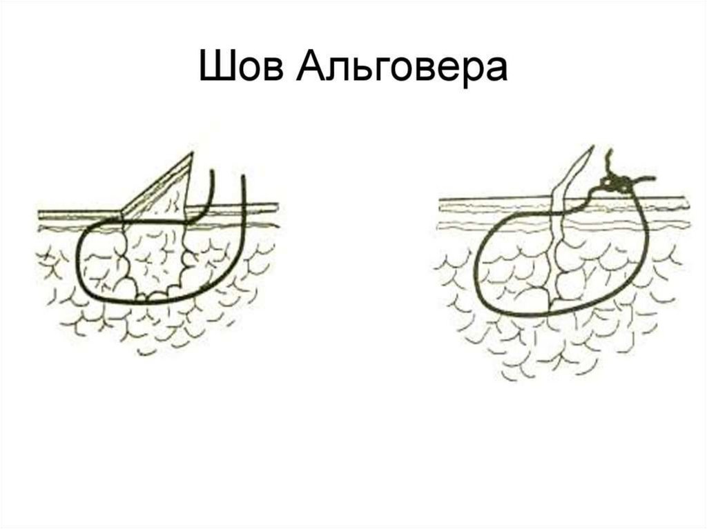Основные хирургические навыки. Лекция 1 - online presentation
