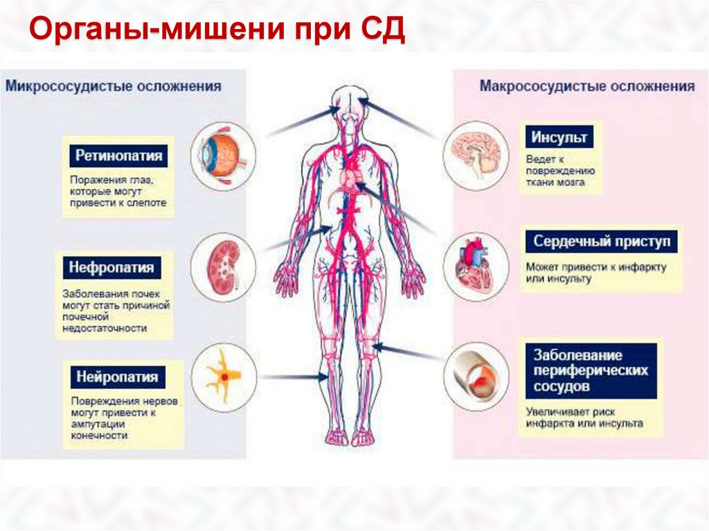 Осложнения сахарного диабета картинки для презентации