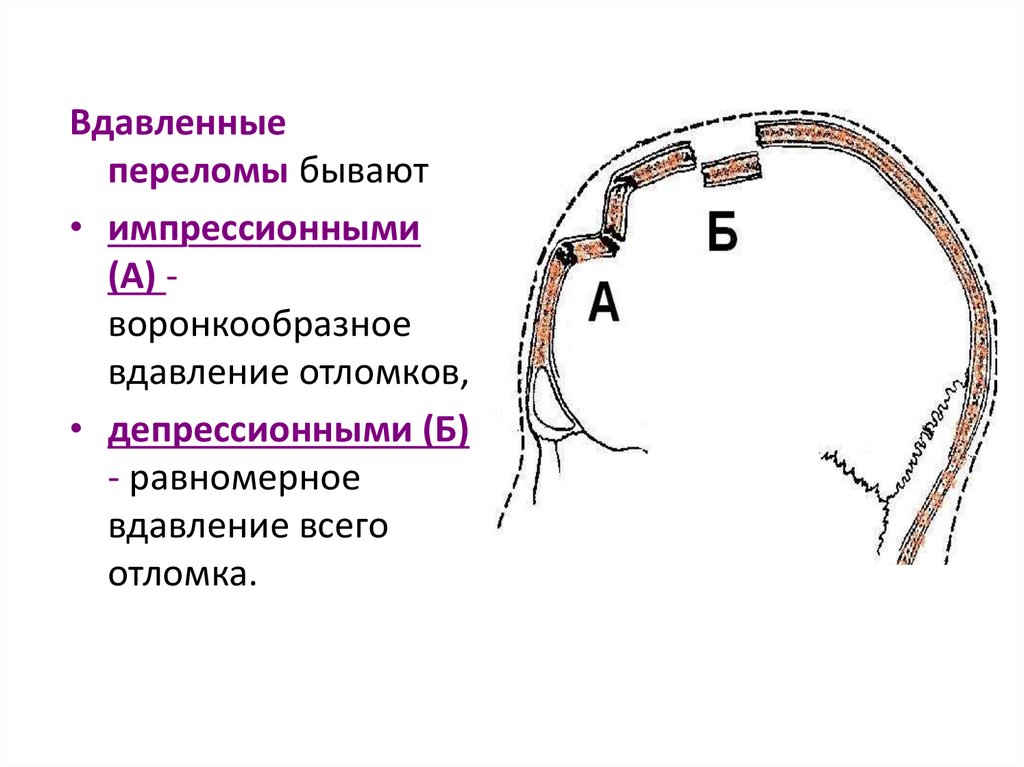 Перелом основания черепа карта вызова