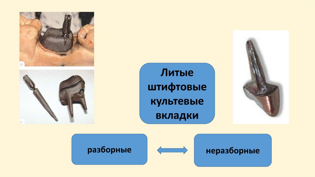 Литые культевые штифтовые вкладки или стандартные штифты?