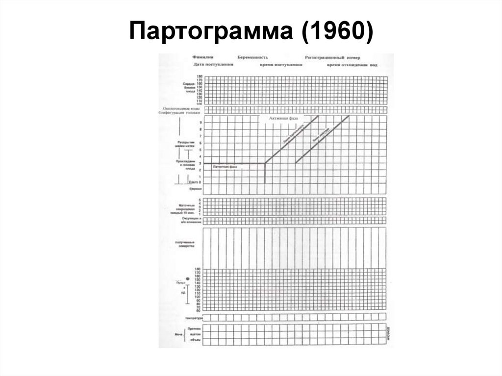 Партограмма (1960)