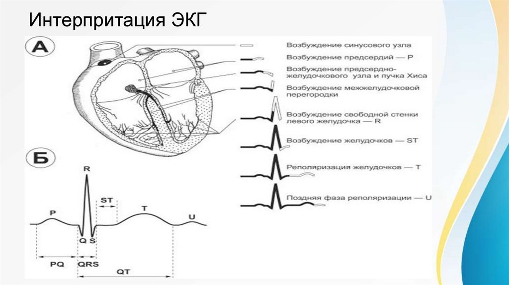 Методика снятия экг