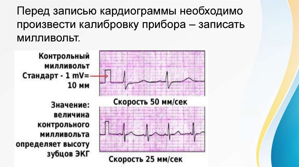 Методика снятия экг