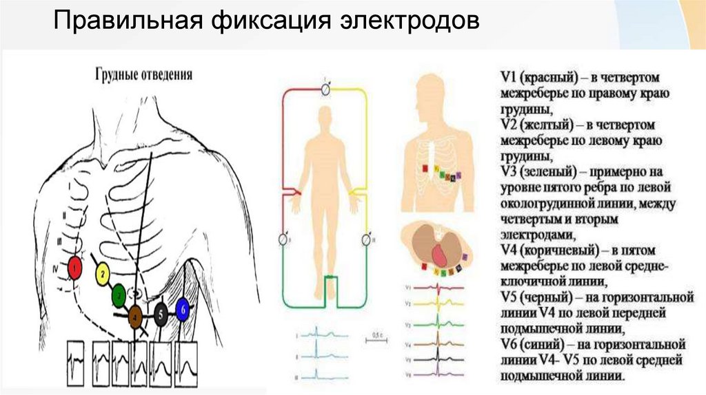 Методика снятия экг