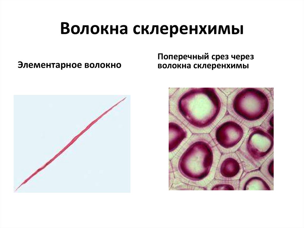 Волокна колленхимы