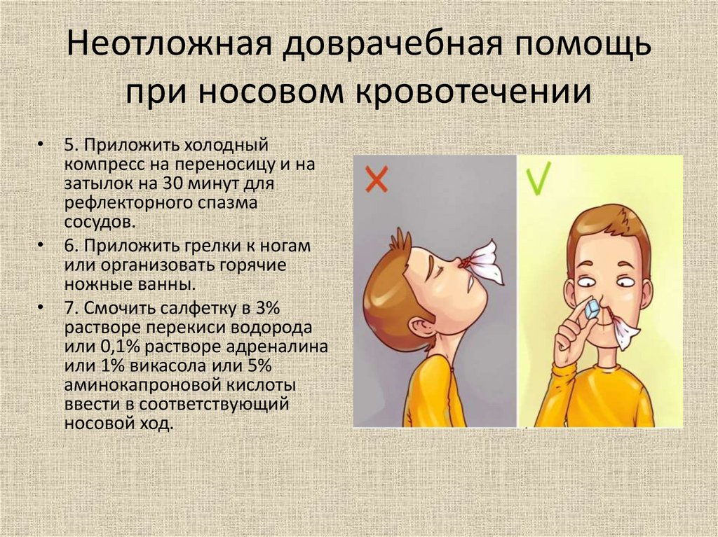 Причины частого кровотечения из носа. При кровотечении из носа. При кровотечении из носа необходимо. Доврачебная помощь при носовом кровотечении. При носовом кровотечении у детей.