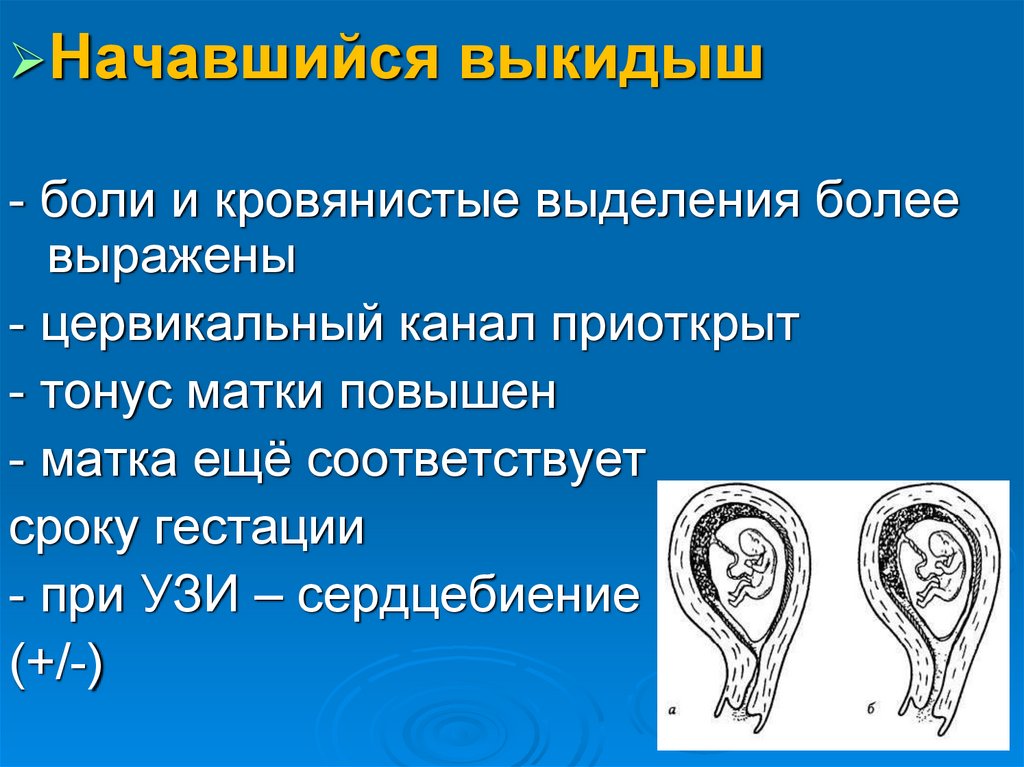 Выделения при дюфастоне при беременности