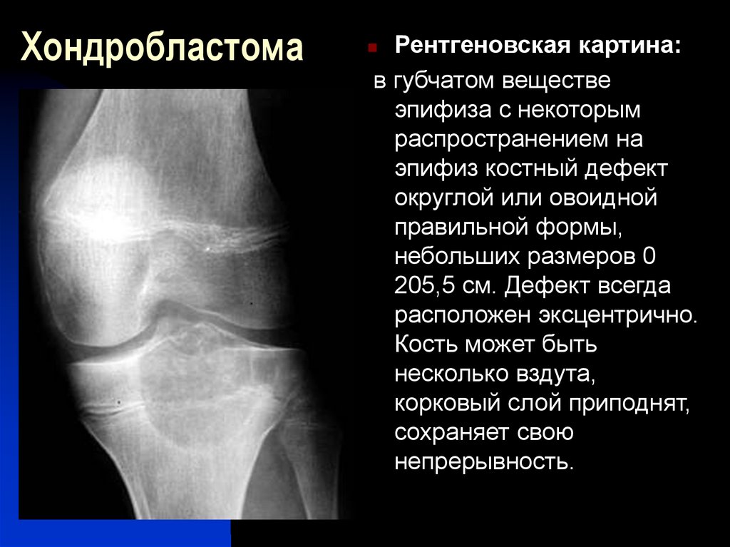 Опухоли общая хирургия презентация