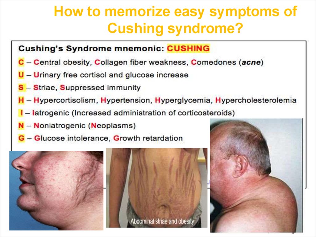 How to memorize easy symptoms of Cushing syndrome?