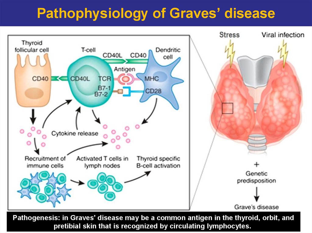 Pathophysiology of Graves’ disease