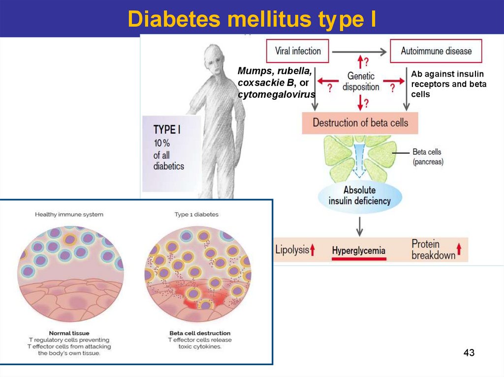 Diabetes mellitus type I