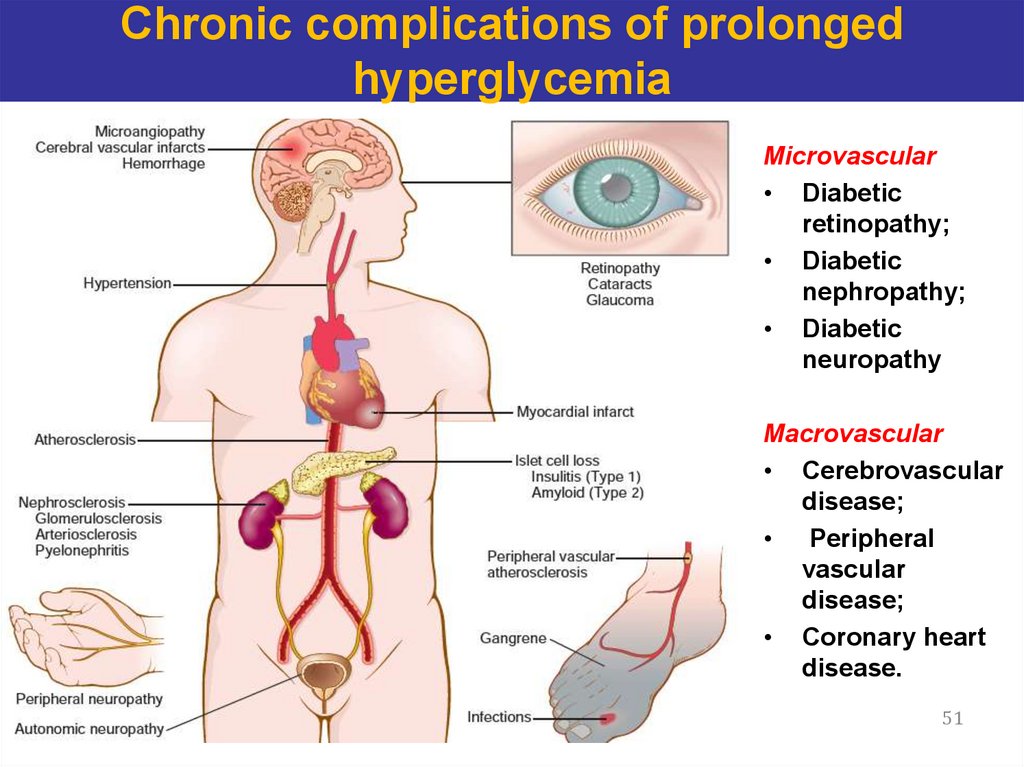 Chronic complications of prolonged hyperglycemia