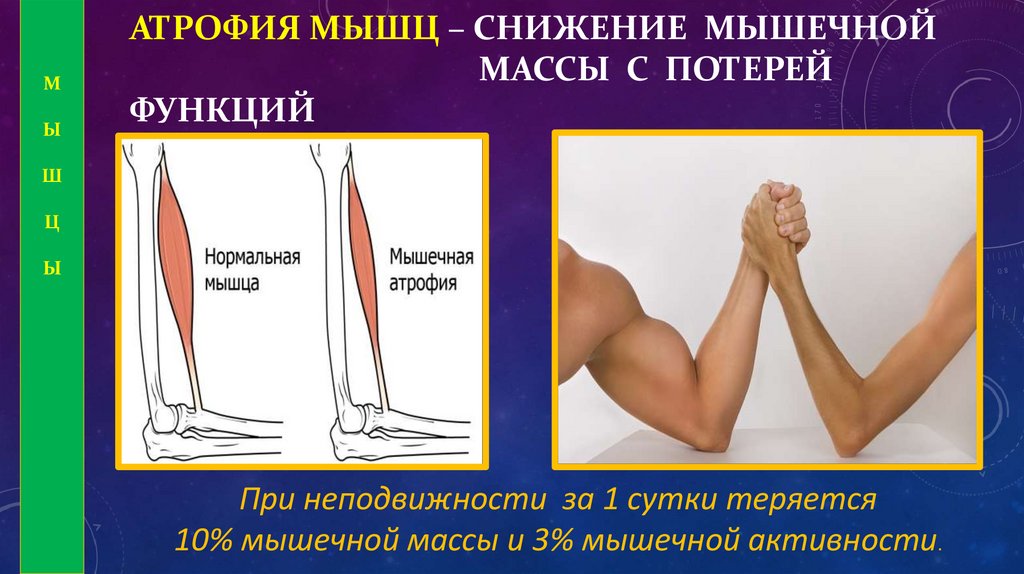 АТРОФИЯ МЫШЦ – снижение МЫШЕЧНОЙ мАССЫ с потерей ФУНКЦИй